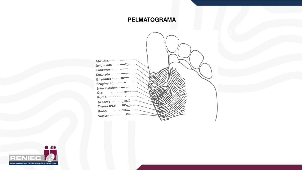 PELMATOGRAMA CONJUNTO ANATÓMICO DE CRESTAS PAPILARES O ESTAMPADO DEL DIBUJO PAPILAR Y A SU REPRESENTACIÓN GRÁFICA CON FINES DIDÁCTICOS O DE ESTUDIO.
