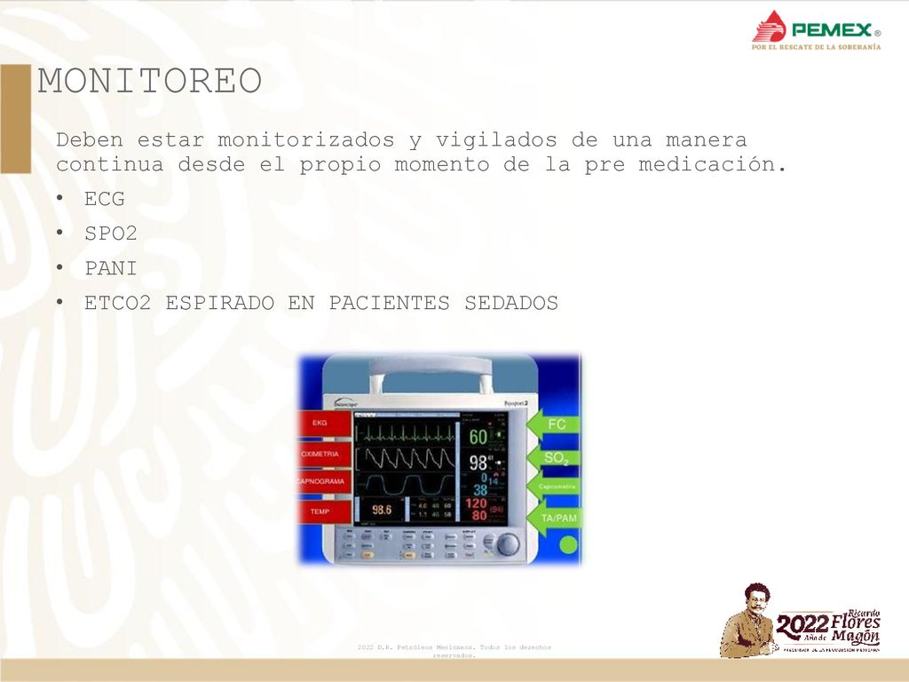 MONITOREO Deben estar monitorizados y vigilados de una manera continua desde el propio momento de la pre medicación.