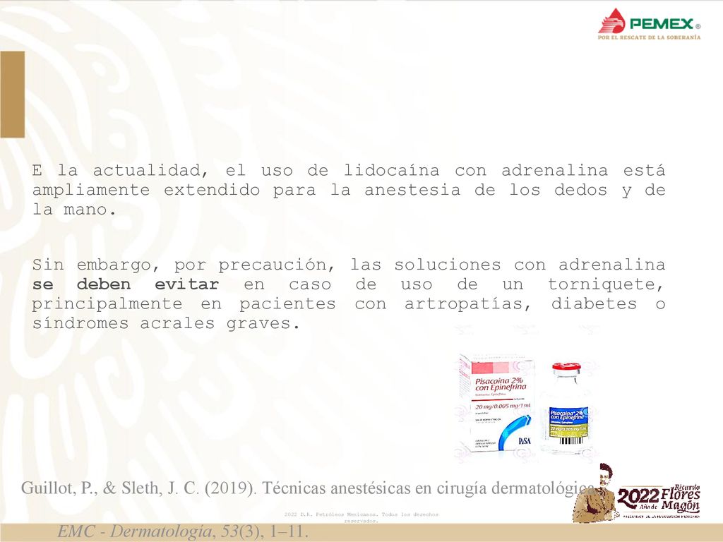 E la actualidad, el uso de lidocaína con adrenalina está ampliamente extendido para la anestesia de los dedos y de la mano. Sin embargo, por precaución, las soluciones con adrenalina se deben evitar en caso de uso de un torniquete, principalmente en pacientes con artropatías, diabetes o síndromes acrales graves.