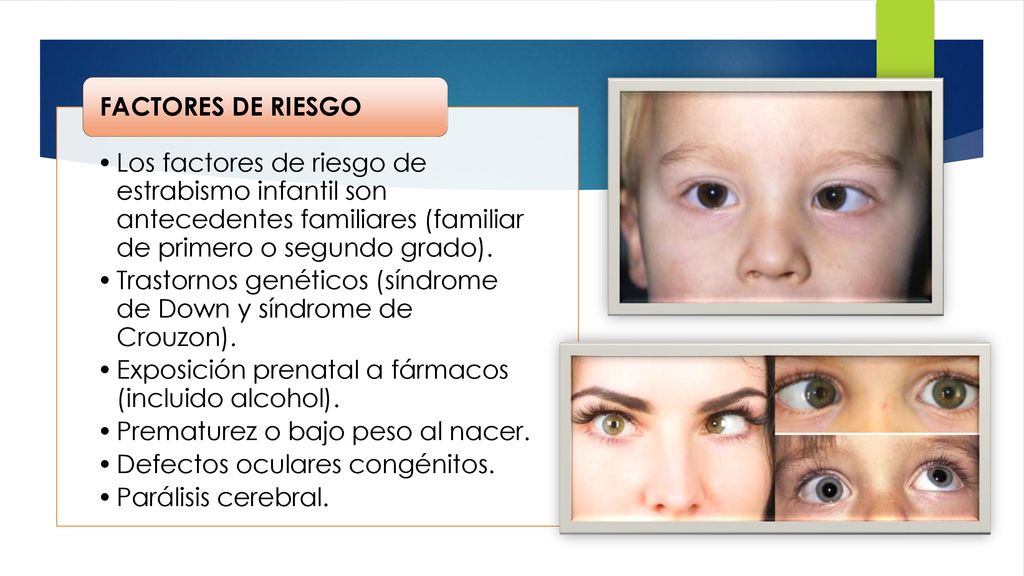 Los factores de riesgo de estrabismo infantil son antecedentes familiares (familiar de primero o segundo grado).