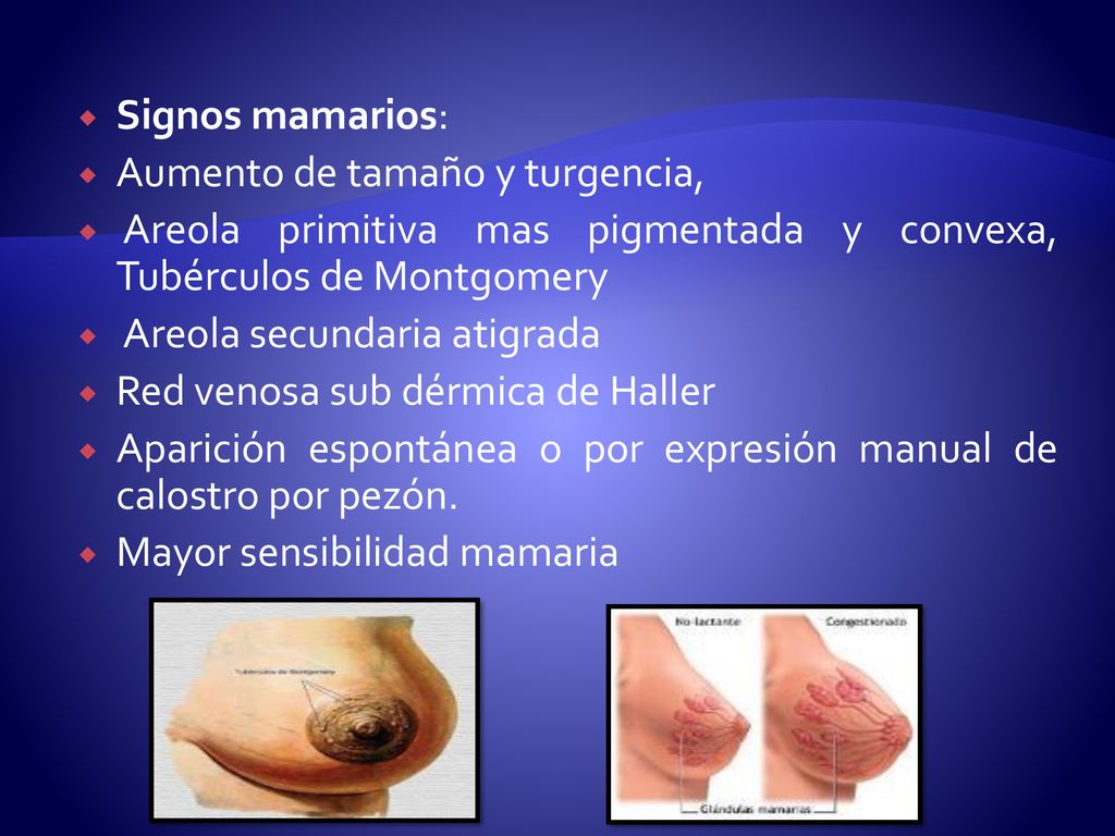 Signos mamarios: Aumento de tamaño y turgencia, Areola primitiva mas pigmentada y convexa, Tubérculos de Montgomery.