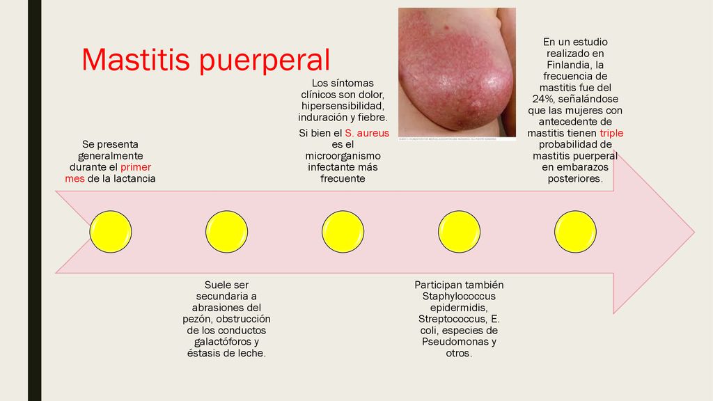 Se presenta generalmente durante el primer mes de la lactancia