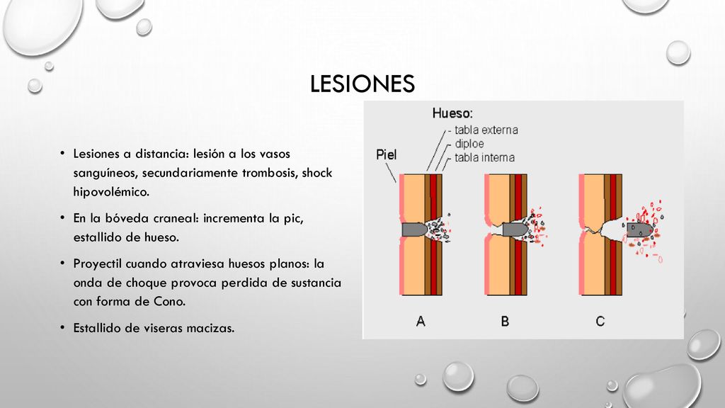 LESIONES Lesiones a distancia: lesión a los vasos sanguíneos, secundariamente trombosis, shock hipovolémico.