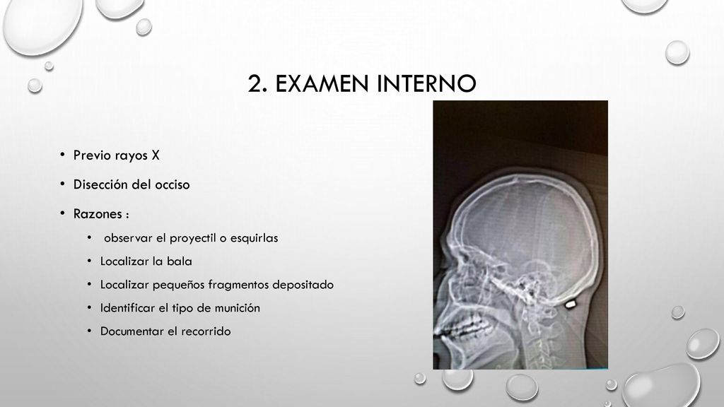 2. Examen interno Previo rayos X Disección del occiso Razones :
