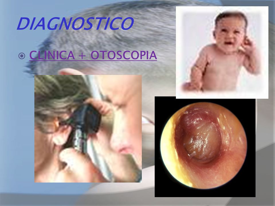 DIAGNOSTICO CLINICA + OTOSCOPIA