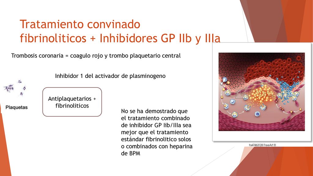 Tratamiento convinado fibrinoliticos + Inhibidores GP IIb y IIIa