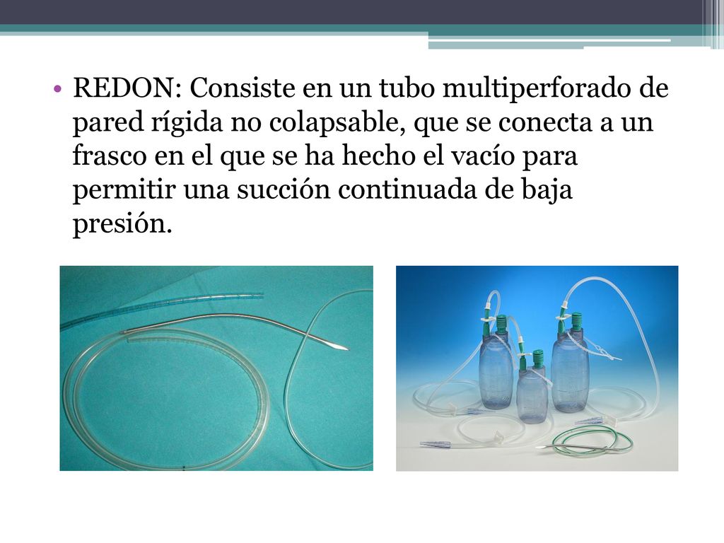 REDON: Consiste en un tubo multiperforado de pared rígida no colapsable, que se conecta a un frasco en el que se ha hecho el vacío para permitir una succión continuada de baja presión.