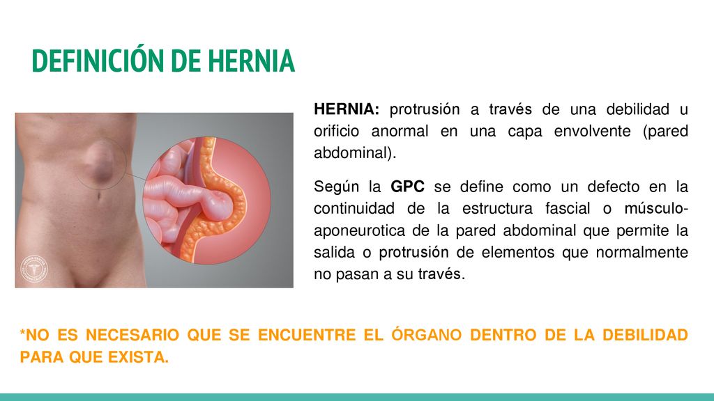 DEFINICIÓN DE HERNIA HERNIA: protrusión a través de una debilidad u orificio anormal en una capa envolvente (pared abdominal).