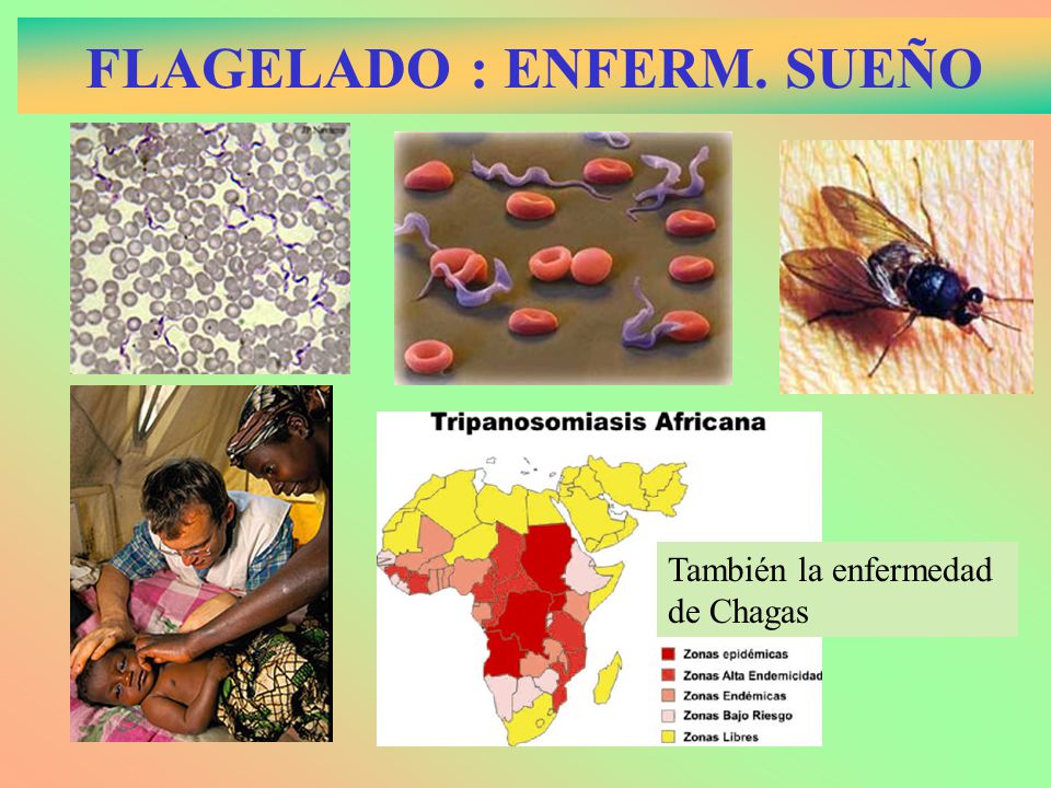 FLAGELADO : ENFERM. SUEÑO
