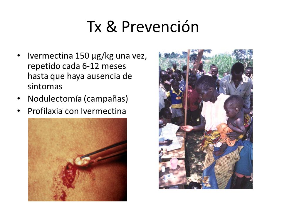 Tx & Prevención Ivermectina 150 µg/kg una vez, repetido cada 6-12 meses hasta que haya ausencia de síntomas.