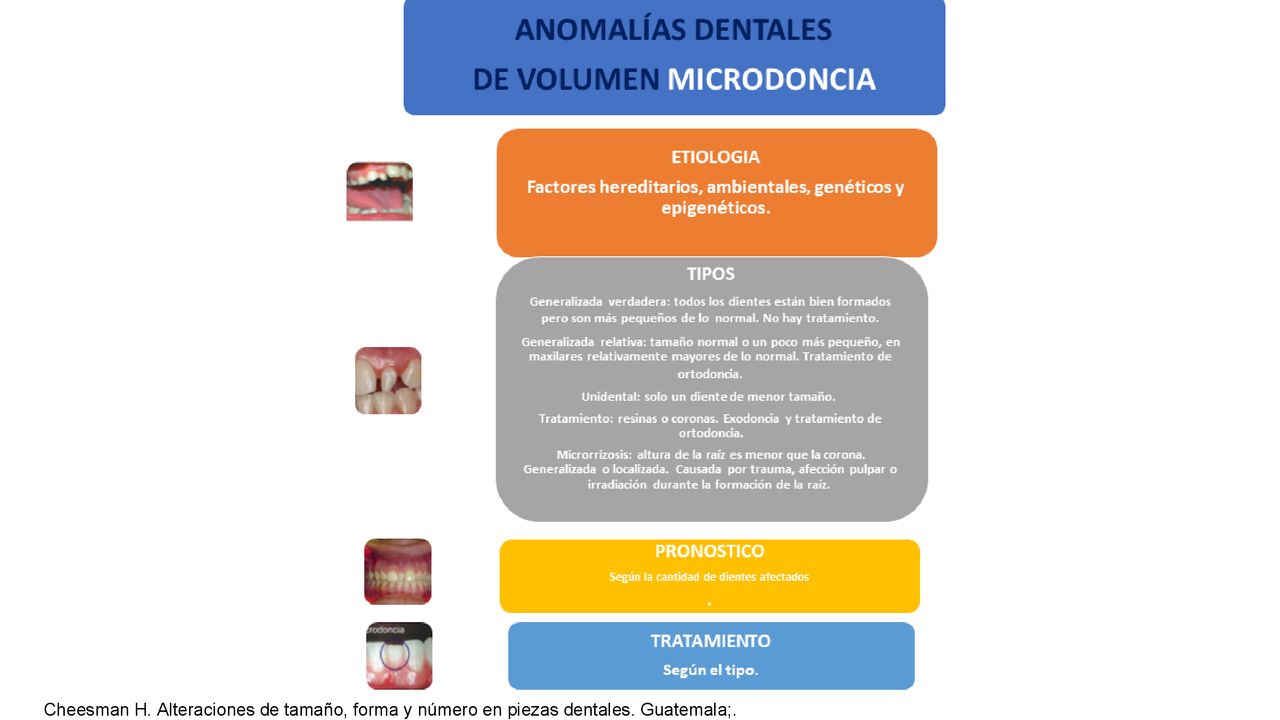 Cheesman H. Alteraciones de tamaño, forma y número en piezas dentales