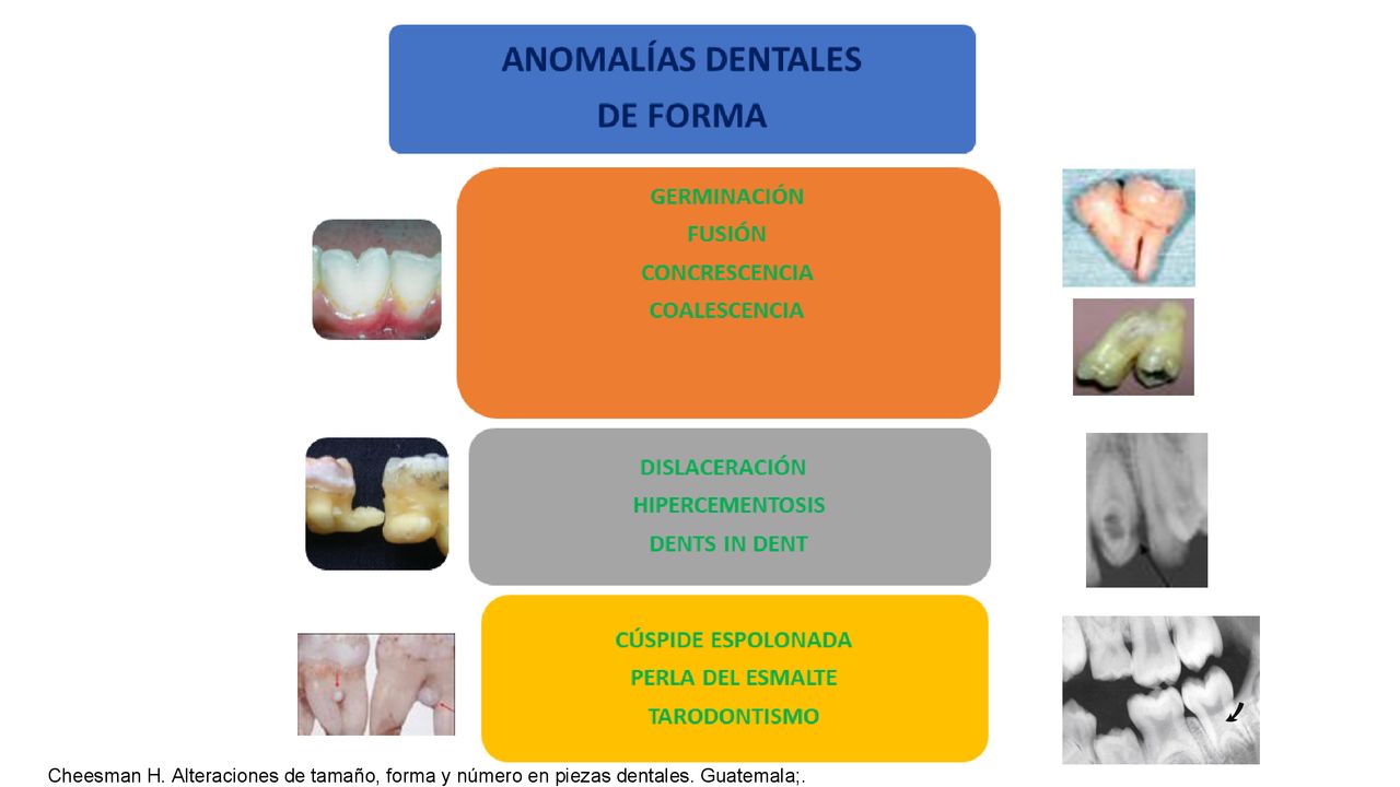 Cheesman H. Alteraciones de tamaño, forma y número en piezas dentales