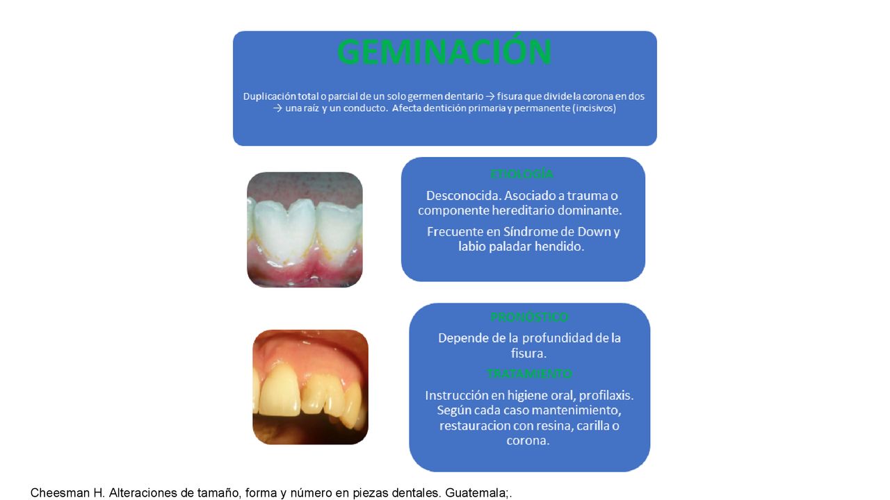 Cheesman H. Alteraciones de tamaño, forma y número en piezas dentales