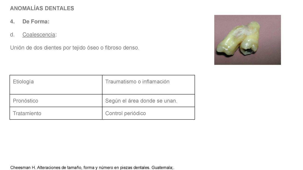 Unión de dos dientes por tejido óseo o fibroso denso.