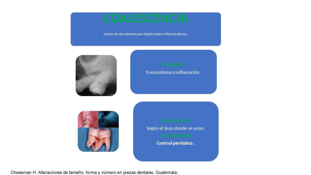 Cheesman H. Alteraciones de tamaño, forma y número en piezas dentales