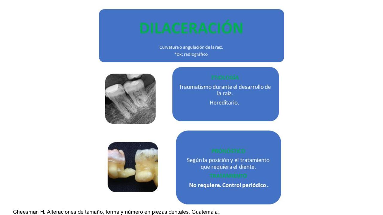 Cheesman H. Alteraciones de tamaño, forma y número en piezas dentales