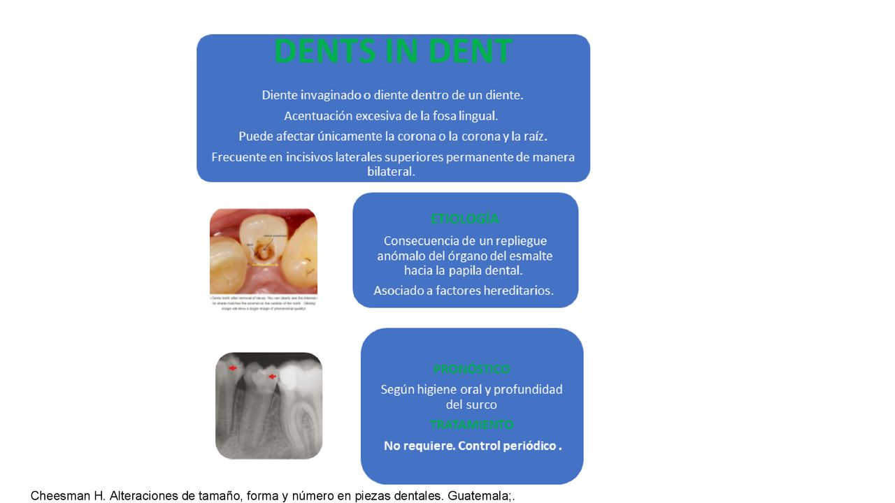 Cheesman H. Alteraciones de tamaño, forma y número en piezas dentales