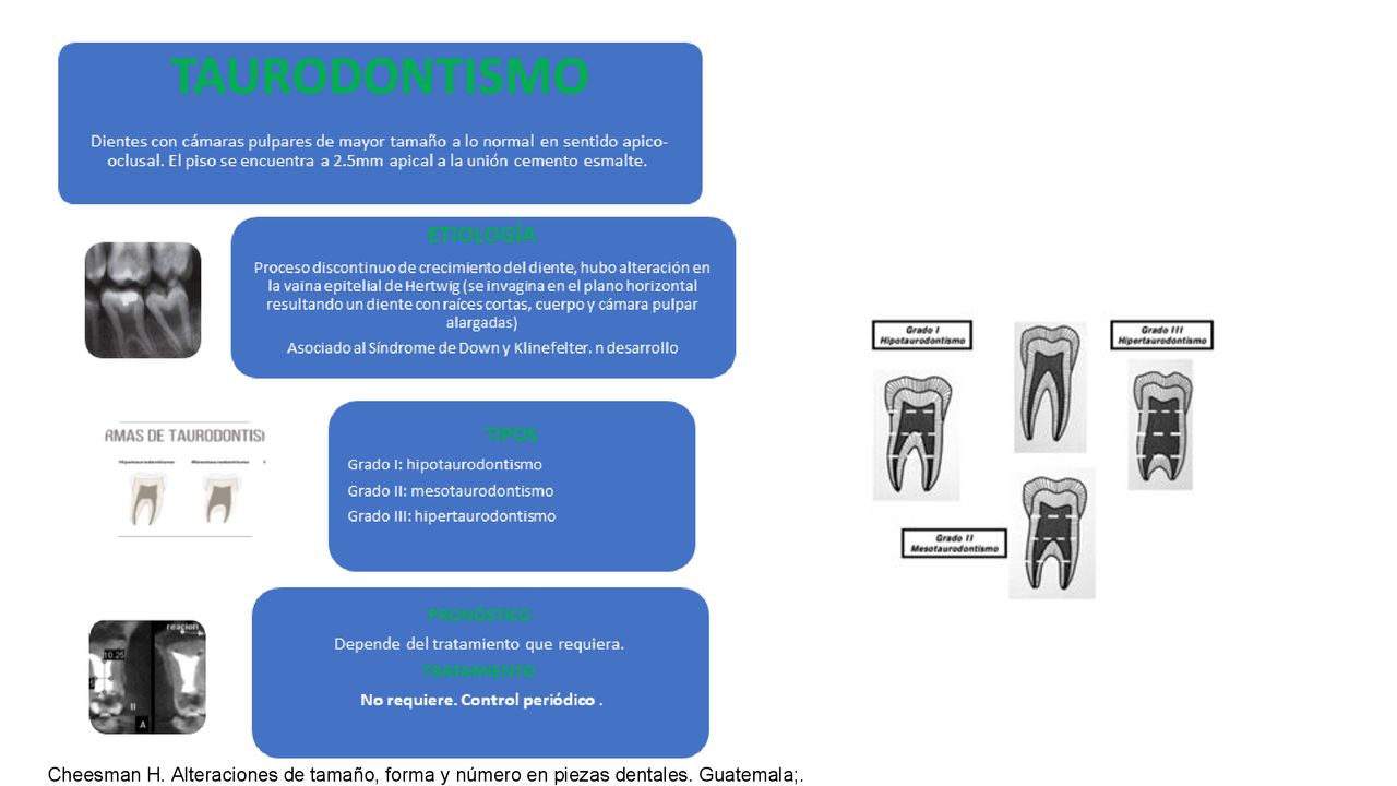 Cheesman H. Alteraciones de tamaño, forma y número en piezas dentales