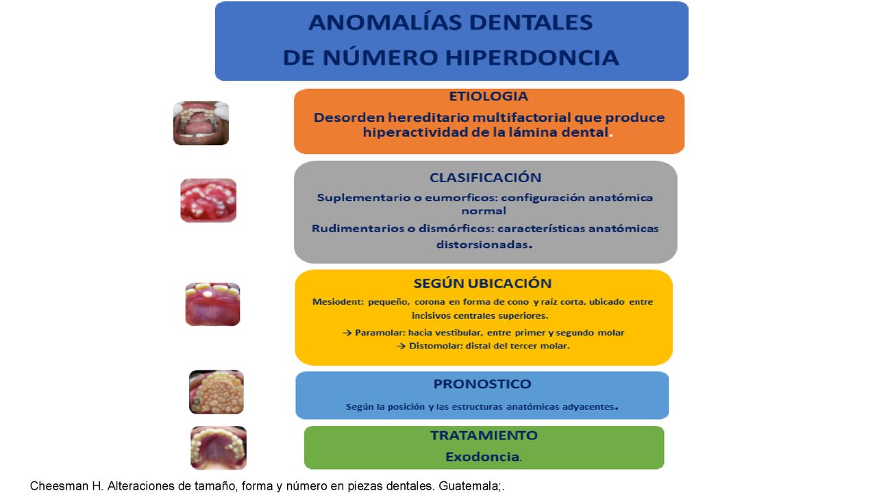 Cheesman H. Alteraciones de tamaño, forma y número en piezas dentales