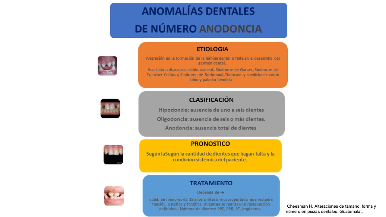 Cheesman H. Alteraciones de tamaño, forma y número en piezas dentales