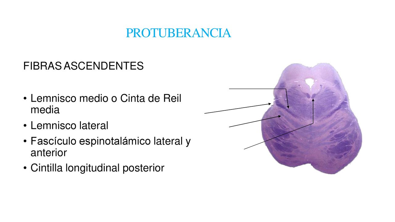 PROTUBERANCIA FIBRAS ASCENDENTES Lemnisco medio o Cinta de Reil media