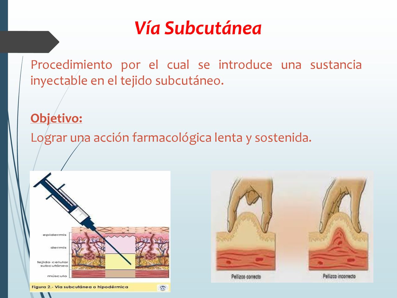 Vía Subcutánea Procedimiento por el cual se introduce una sustancia inyectable en el tejido subcutáneo.