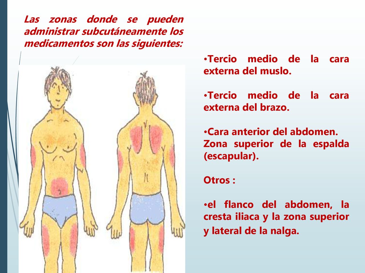 Las zonas donde se pueden administrar subcutáneamente los medicamentos son las siguientes: