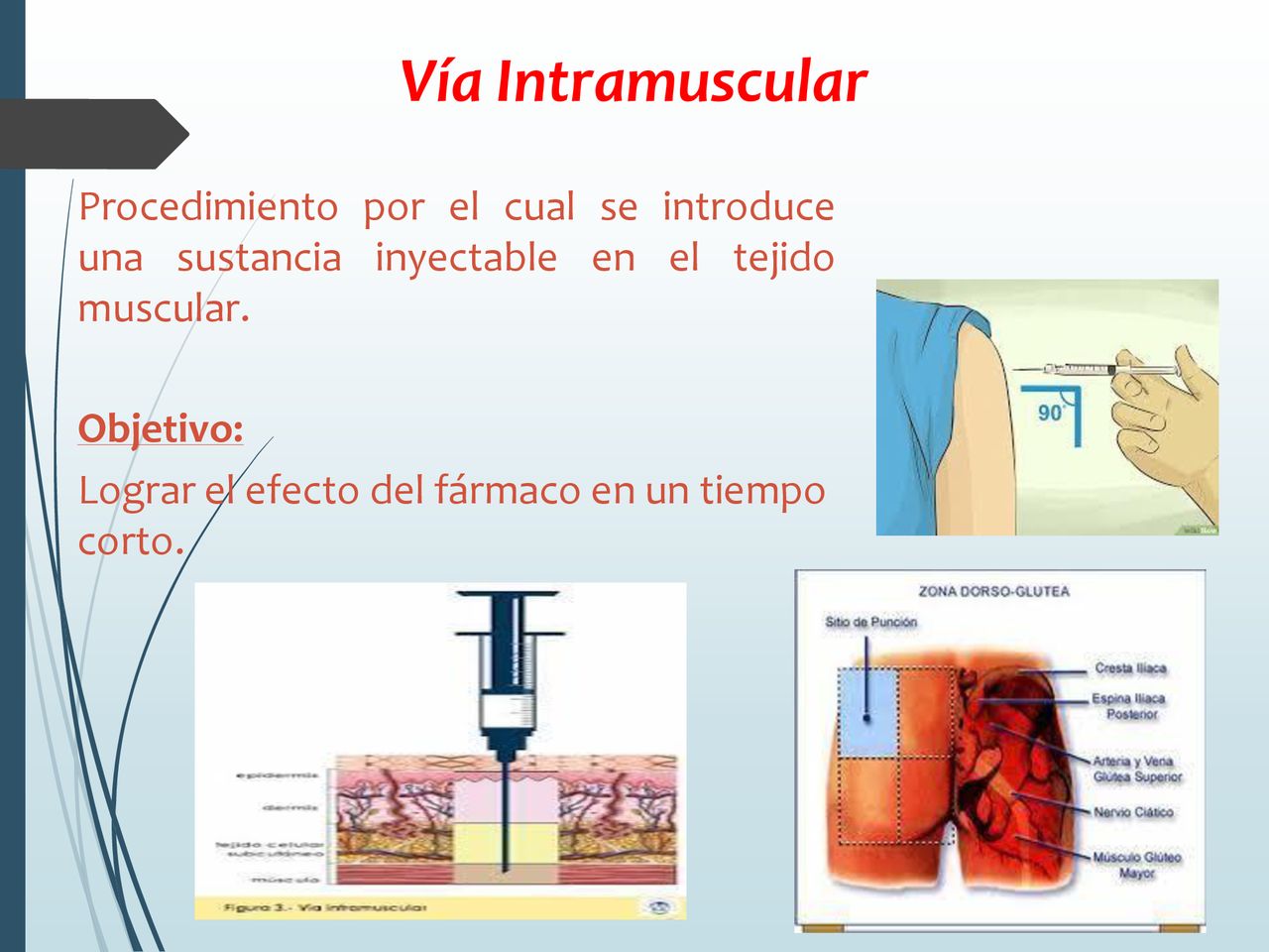 Vía Intramuscular Procedimiento por el cual se introduce una sustancia inyectable en el tejido muscular.