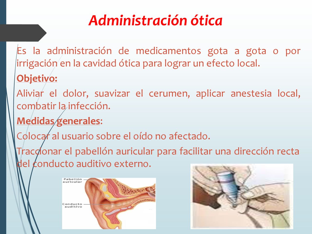 Administración ótica Es la administración de medicamentos gota a gota o por irrigación en la cavidad ótica para lograr un efecto local.