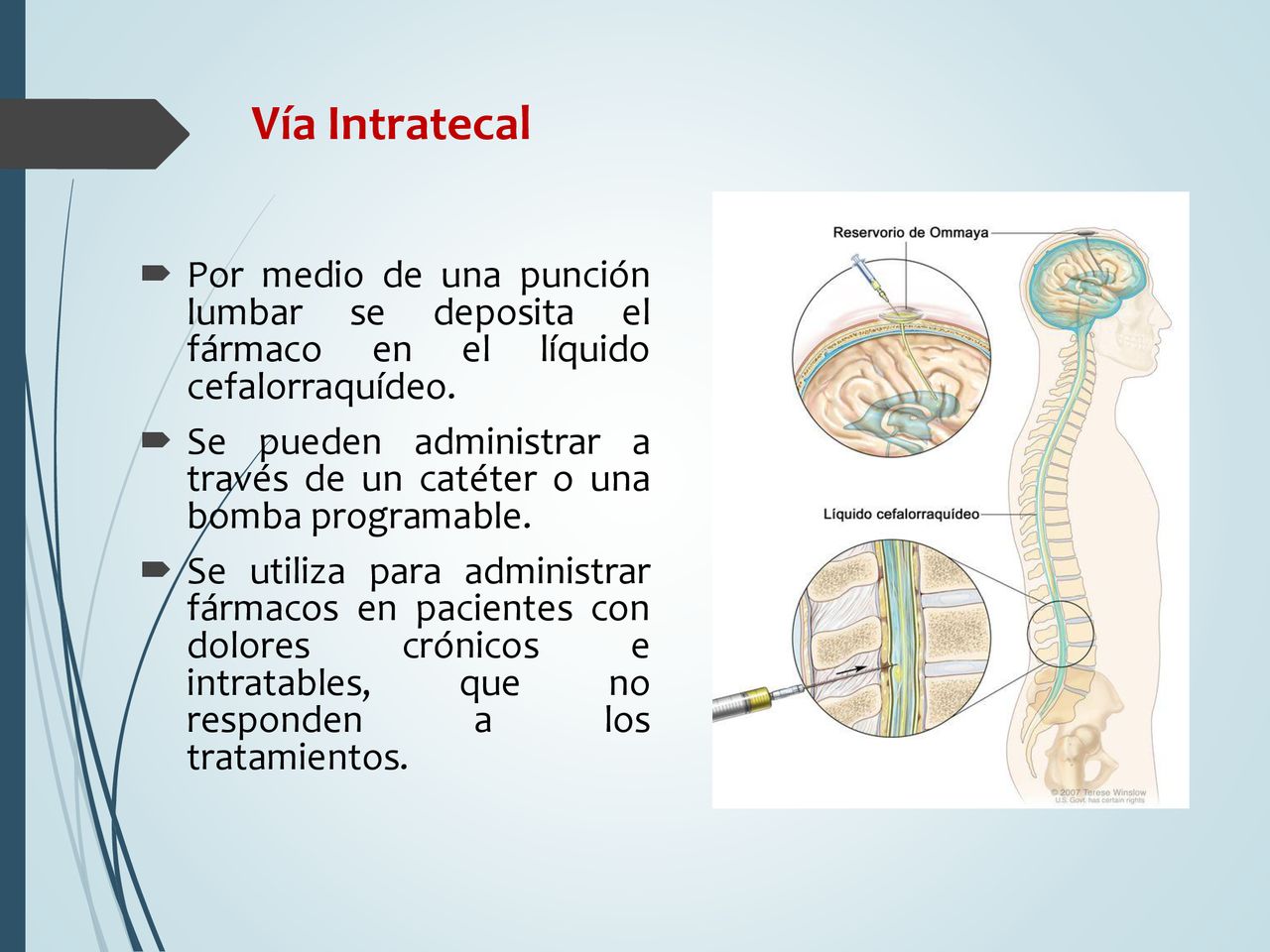 Vía Intratecal Por medio de una punción lumbar se deposita el fármaco en el líquido cefalorraquídeo.