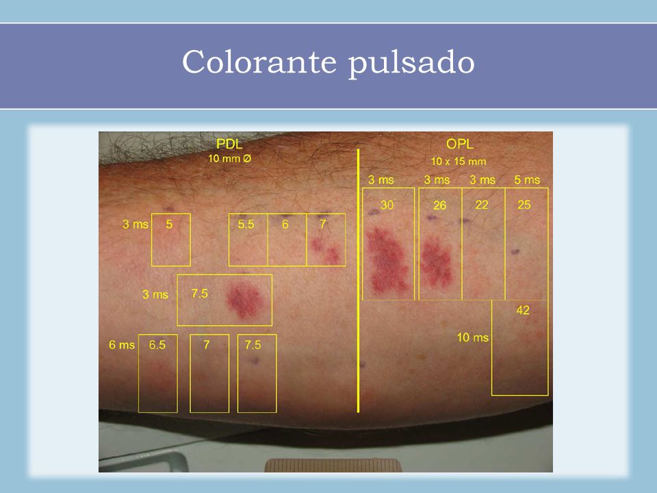 Colorante pulsado