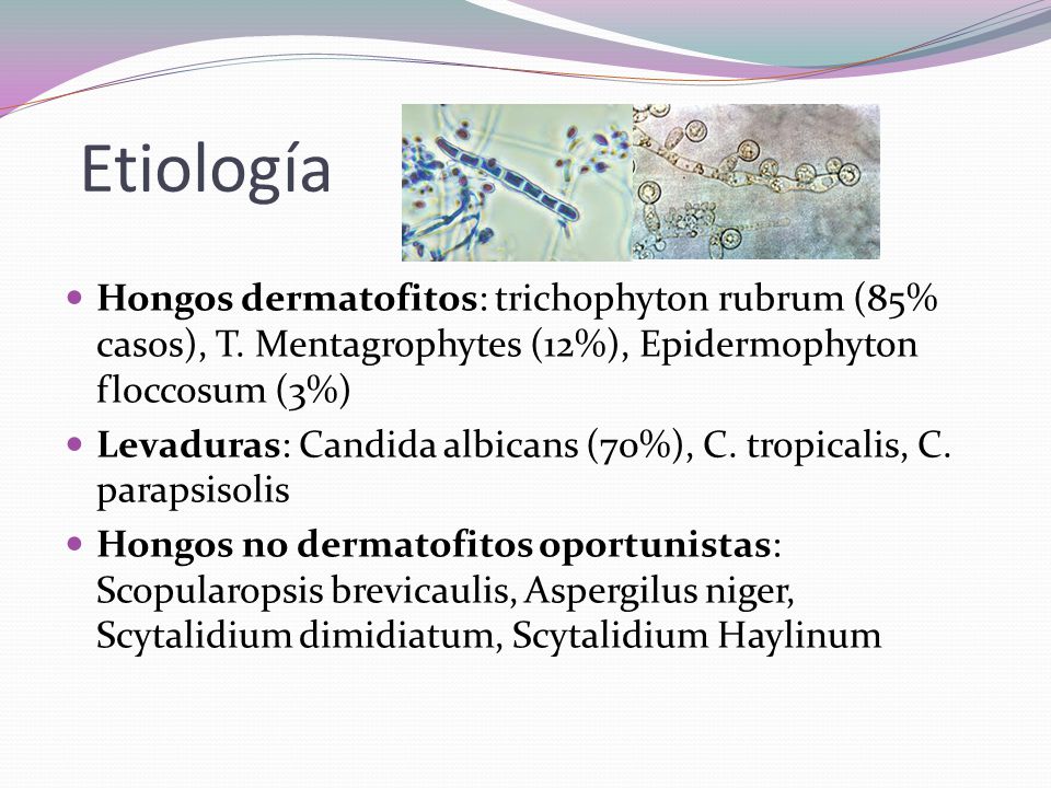Etiología Hongos dermatofitos: trichophyton rubrum (85% casos), T. Mentagrophytes (12%), Epidermophyton floccosum (3%)