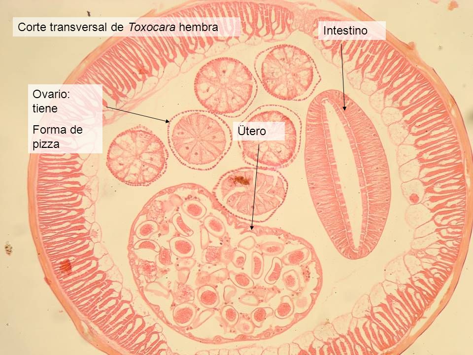 Corte transversal de Toxocara hembra