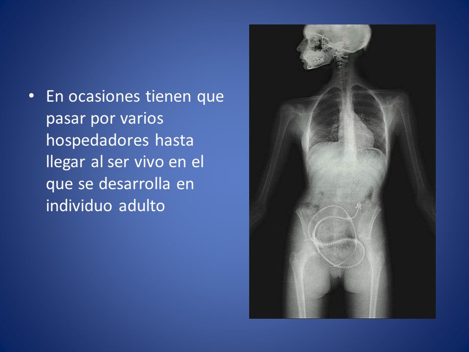 En ocasiones tienen que pasar por varios hospedadores hasta llegar al ser vivo en el que se desarrolla en individuo adulto