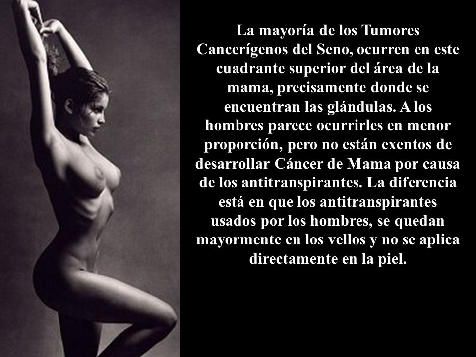 La mayoría de los Tumores Cancerígenos del Seno, ocurren en este cuadrante superior del área de la mama, precisamente donde se encuentran las glándulas.