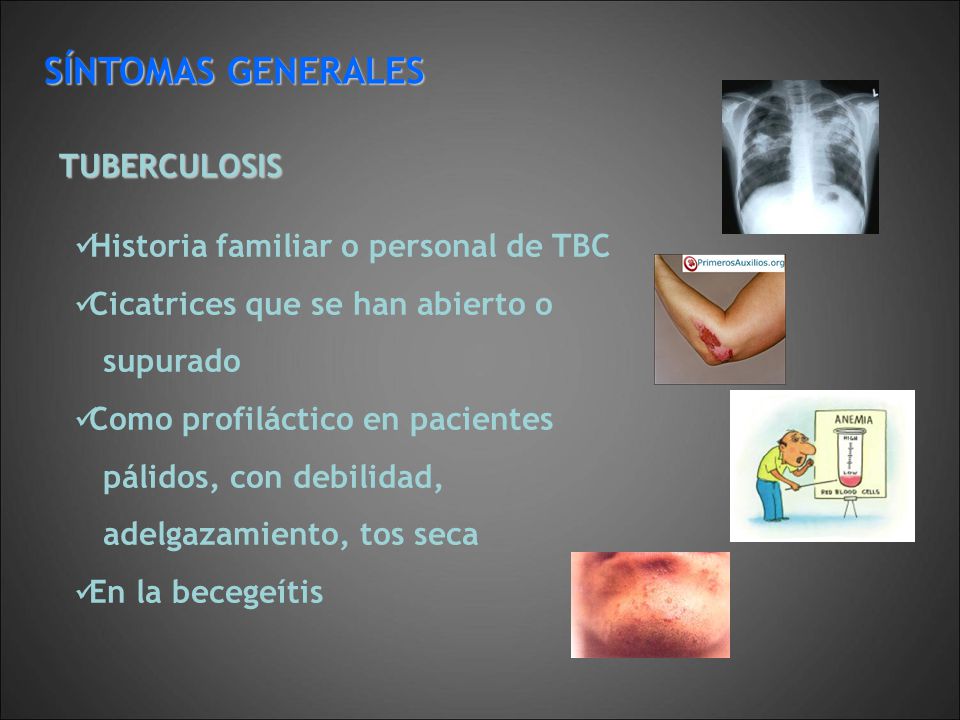 SÍNTOMAS GENERALES TUBERCULOSIS Historia familiar o personal de TBC