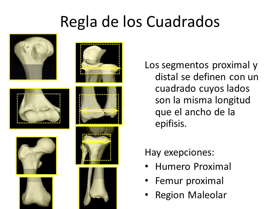 Regla de los Cuadrados Los segmentos proximal y distal se definen con un cuadrado cuyos lados son la misma longitud que el ancho de la epifisis.