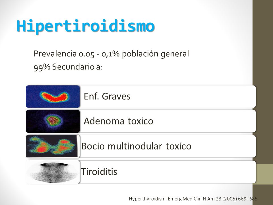 Hipertiroidismo Enf. Graves Adenoma toxico Bocio multinodular toxico