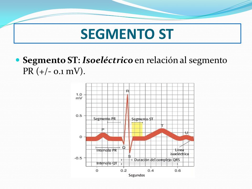 SEGMENTO ST Segmento ST: Isoeléctrico en relación al segmento PR (+/- 0.1 mV).