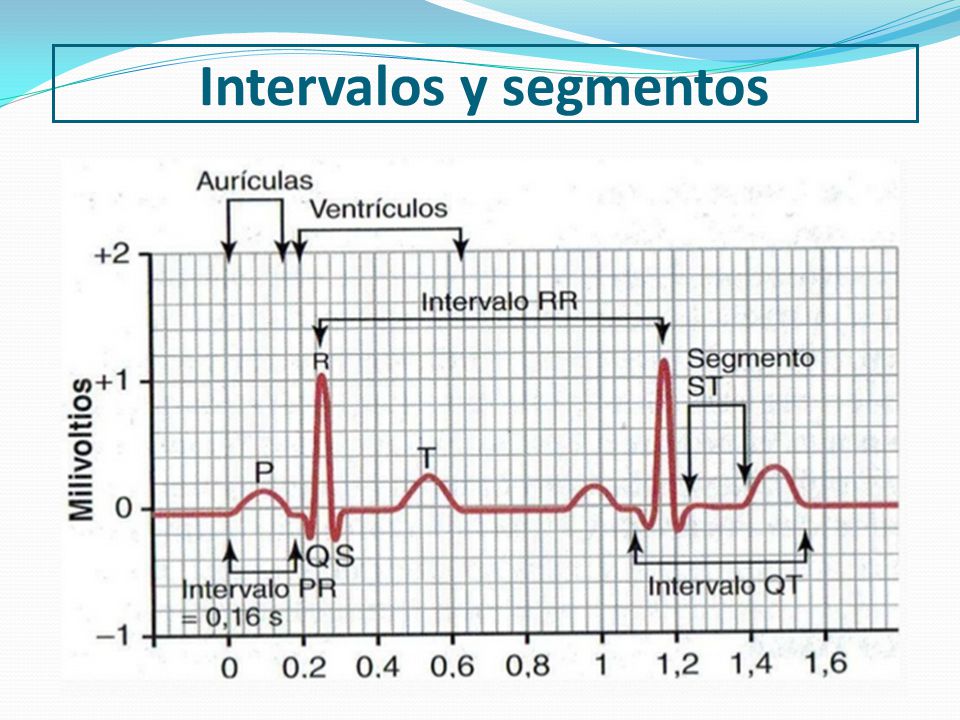 Intervalos y segmentos