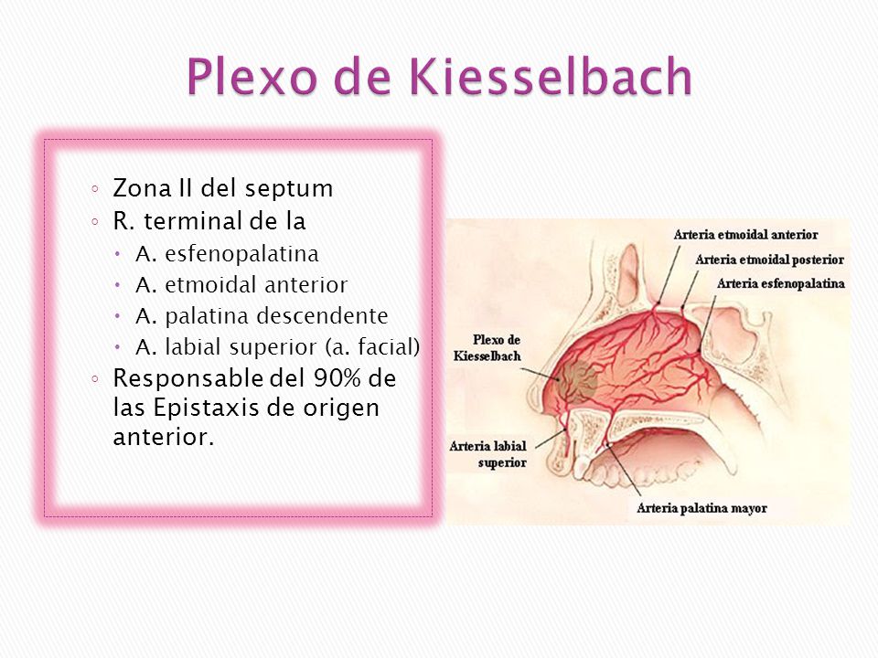 Plexo de Kiesselbach Zona II del septum R. terminal de la