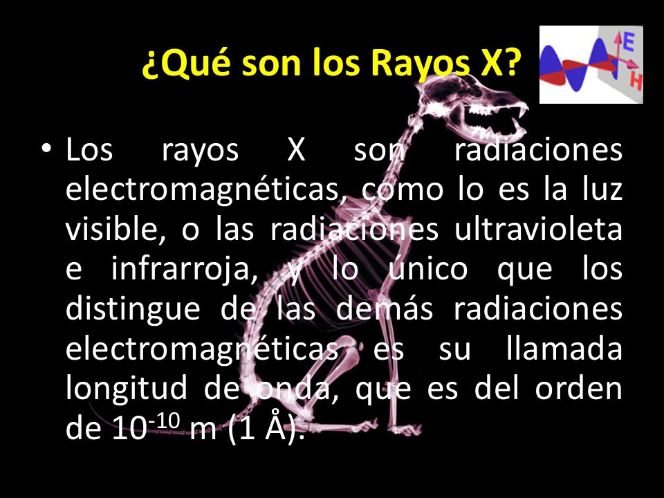 ¿Qué son los Rayos X