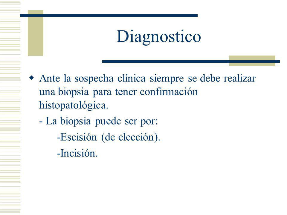 Diagnostico Ante la sospecha clínica siempre se debe realizar una biopsia para tener confirmación histopatológica.