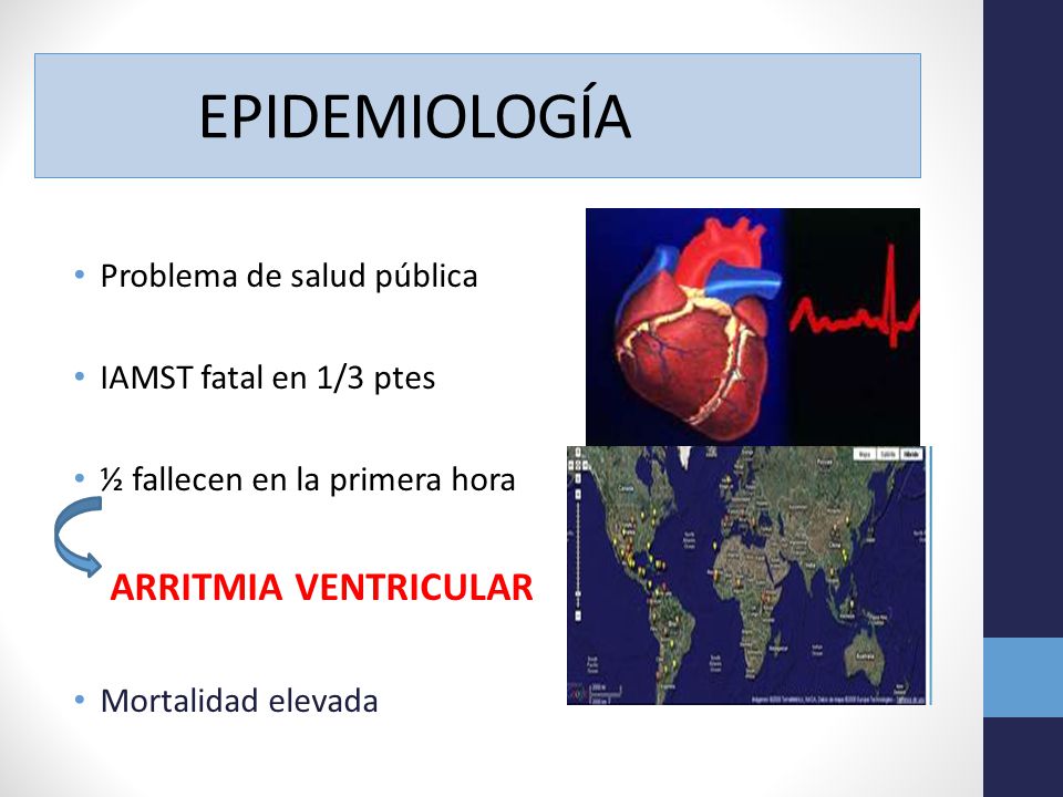 EPIDEMIOLOGÍA Problema de salud pública IAMST fatal en 1/3 ptes
