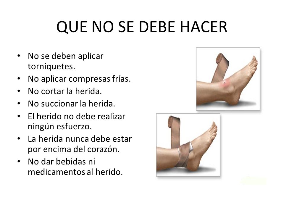 QUE NO SE DEBE HACER No se deben aplicar torniquetes.