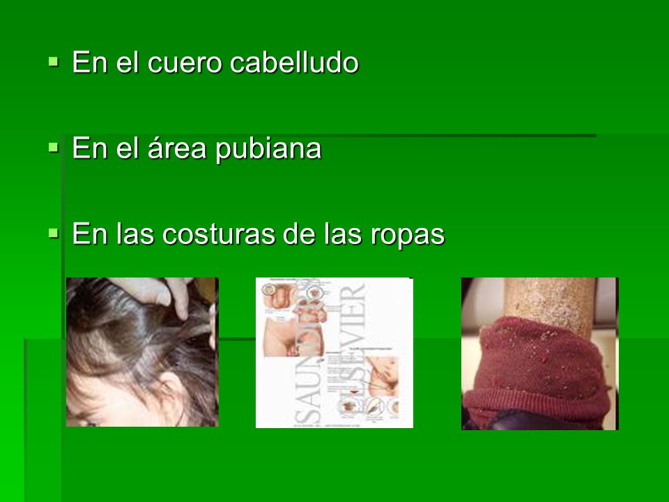 En el cuero cabelludo En el área pubiana En las costuras de las ropas