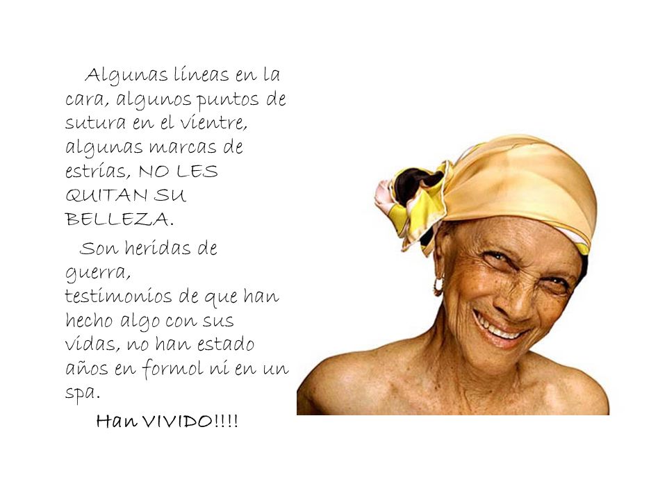 Algunas líneas en la cara, algunos puntos de sutura en el vientre, algunas marcas de estrías, NO LES QUITAN SU BELLEZA.