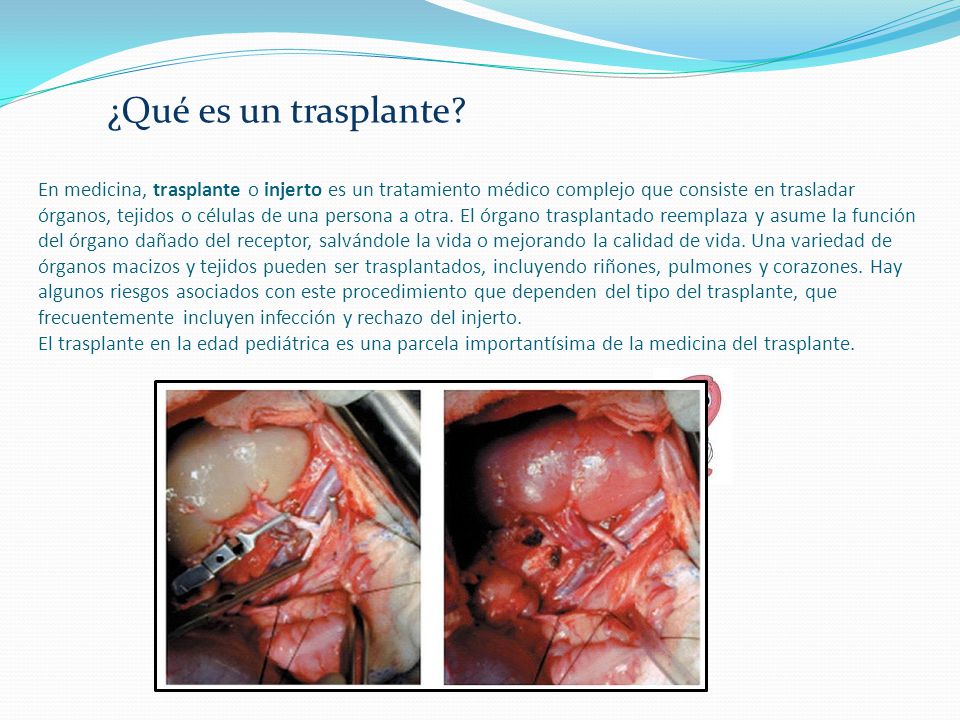 https://slideplayer.es/slide/1861428/7/images/3/%C2%BFQu%C3%A9+es+un+trasplante.jpg