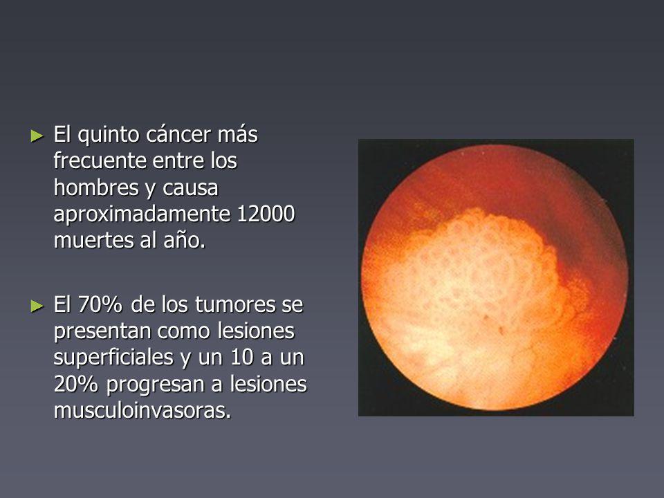 El quinto cáncer más frecuente entre los hombres y causa aproximadamente muertes al año.