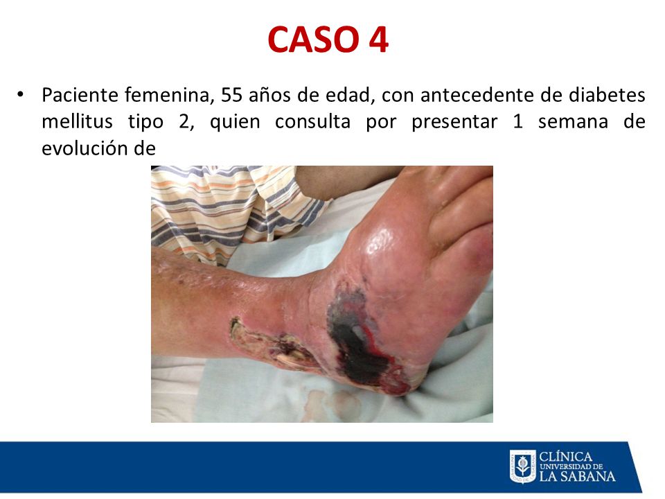 CASO 4 Paciente femenina, 55 años de edad, con antecedente de diabetes mellitus tipo 2, quien consulta por presentar 1 semana de evolución de.
